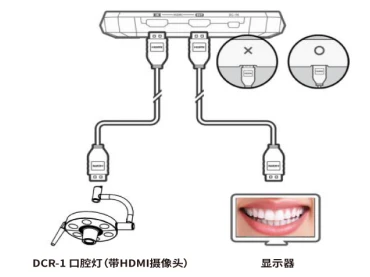 Advanced Dental Equipment: Dental Implant Units